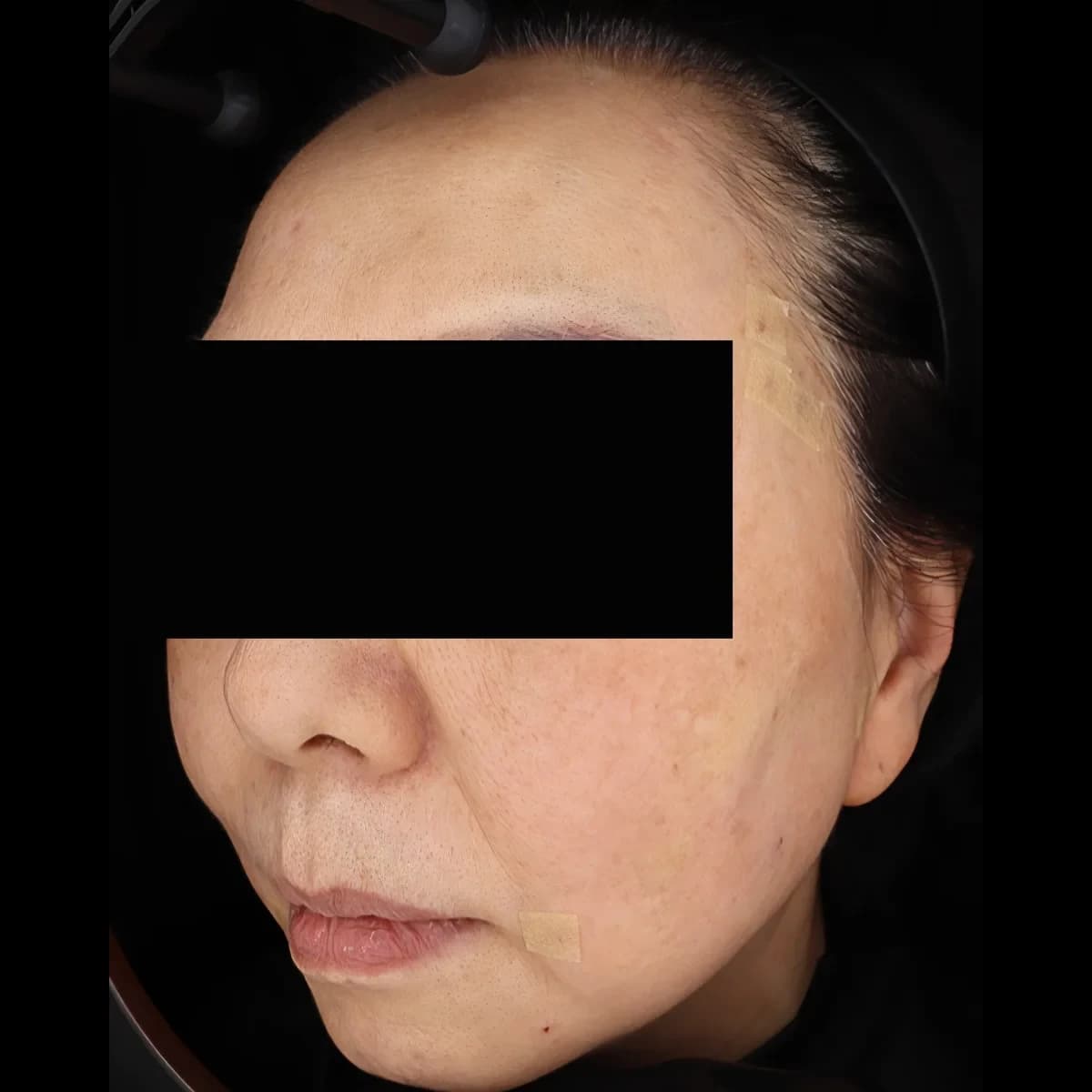 야누스 피부 진단기로 촬영한 실제 화면