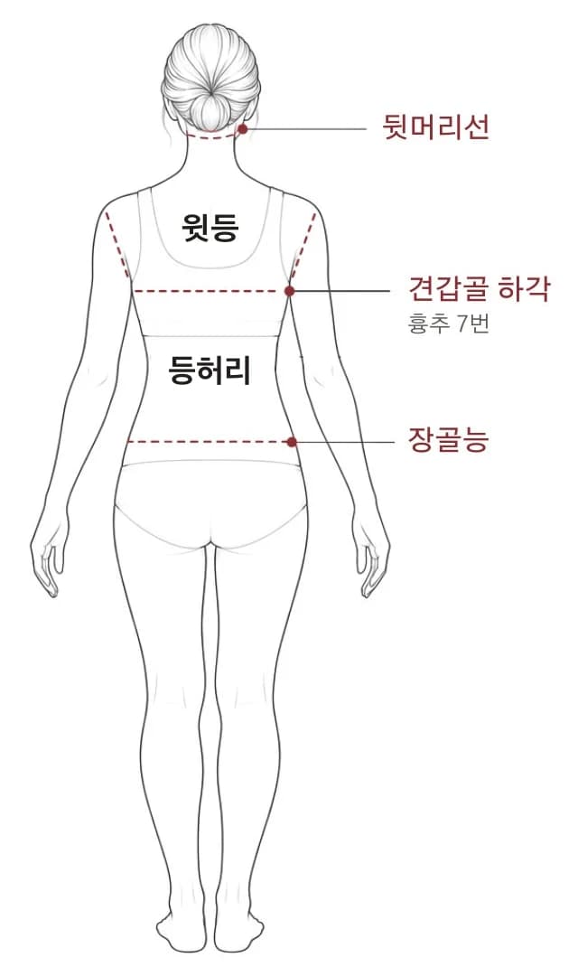 편평사마귀 시술 부위 경계 — 뒷면
