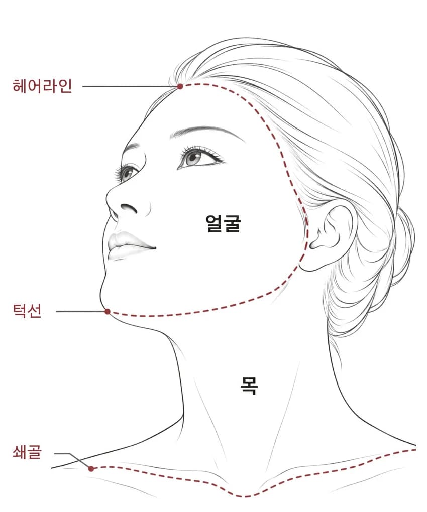 편평사마귀 시술 부위 경계 — 얼굴 · 목